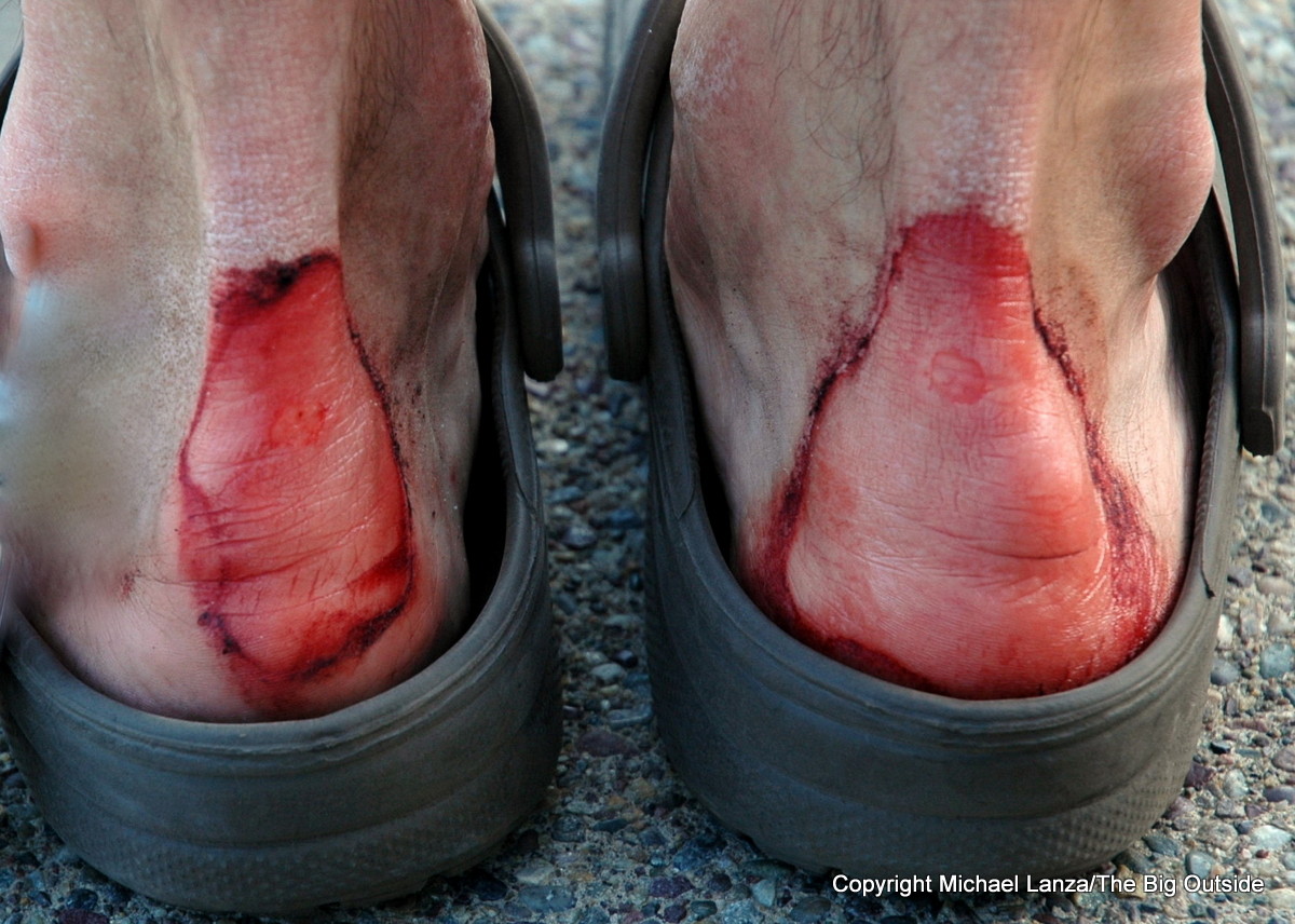 8 Pro Tips For Preventing Blisters When Hiking