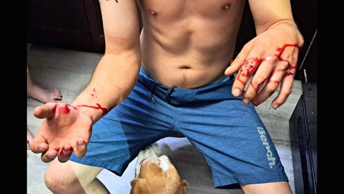Man Fights Off Bobcat With His Bare Hands to Save Dog